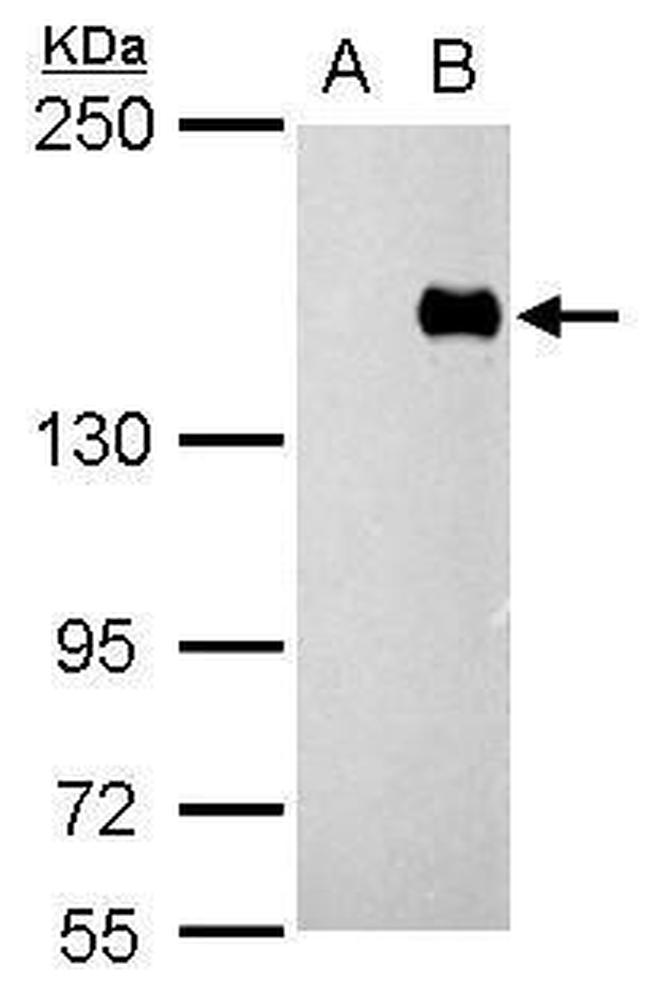 PREX1 Antibody in Western Blot (WB)
