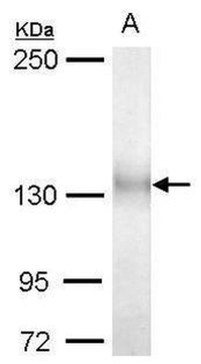 ULK1 Antibody in Western Blot (WB)