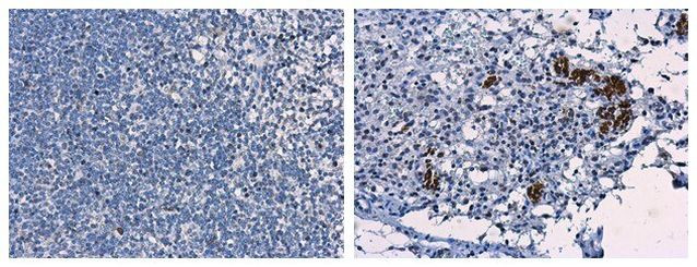 Porcine Circovirus Type 2 Capsid Antibody in Immunohistochemistry (Paraffin) (IHC (P))