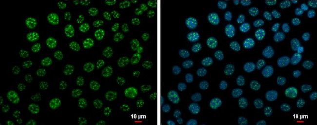 Phospho-RAD17 (Ser646) Antibody in Immunocytochemistry (ICC/IF)