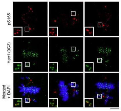 Phospho-HEC1 (Ser165) Antibody in Immunocytochemistry (ICC/IF)
