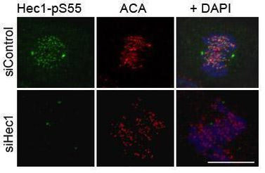 Phospho-HEC1 (Ser55) Antibody in Immunocytochemistry (ICC/IF)