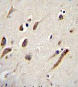 FBXW11 Antibody in Immunohistochemistry (Paraffin) (IHC (P))