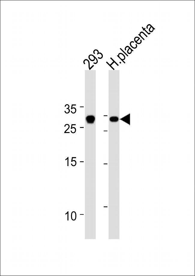 TCF21 Antibody in Western Blot (WB)
