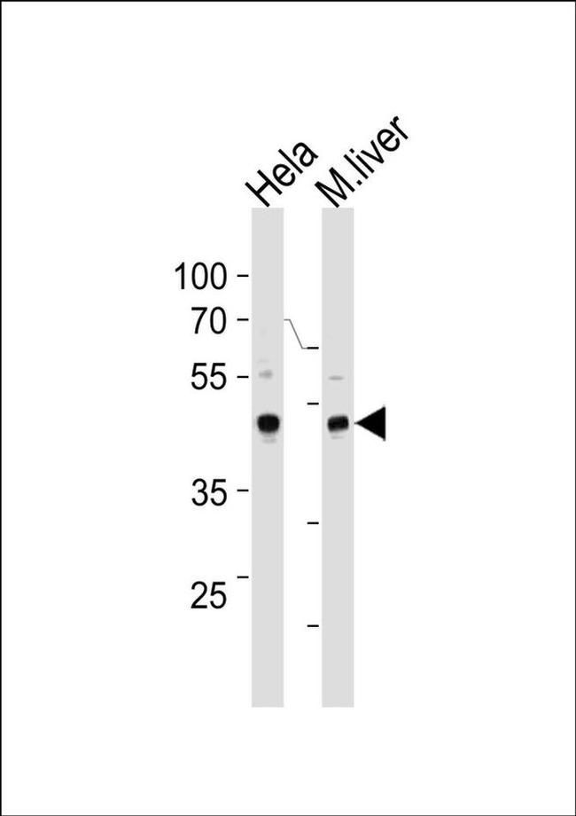 TBX6 Antibody in Western Blot (WB)
