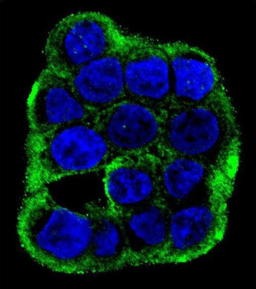 CLCN7 Antibody in Immunocytochemistry (ICC/IF)