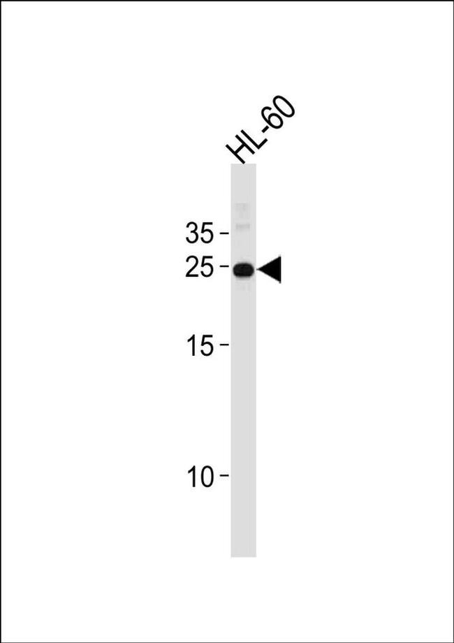 HOXA6 Antibody in Western Blot (WB)