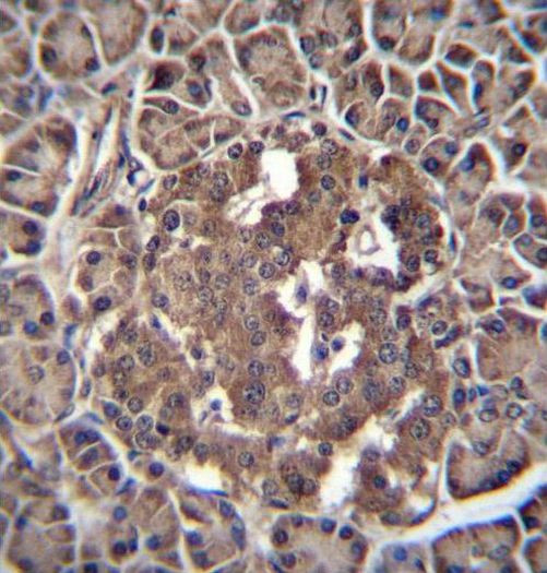 RBPJL Antibody in Immunohistochemistry (Paraffin) (IHC (P))