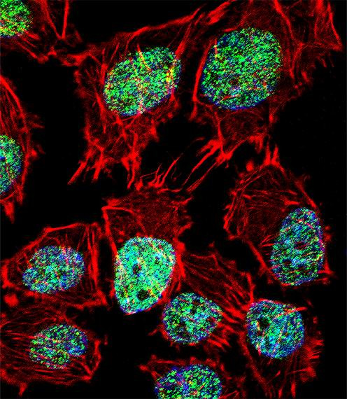 FOXO6 Antibody in Immunocytochemistry (ICC/IF)