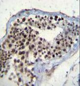 SOX15 Antibody in Immunohistochemistry (Paraffin) (IHC (P))