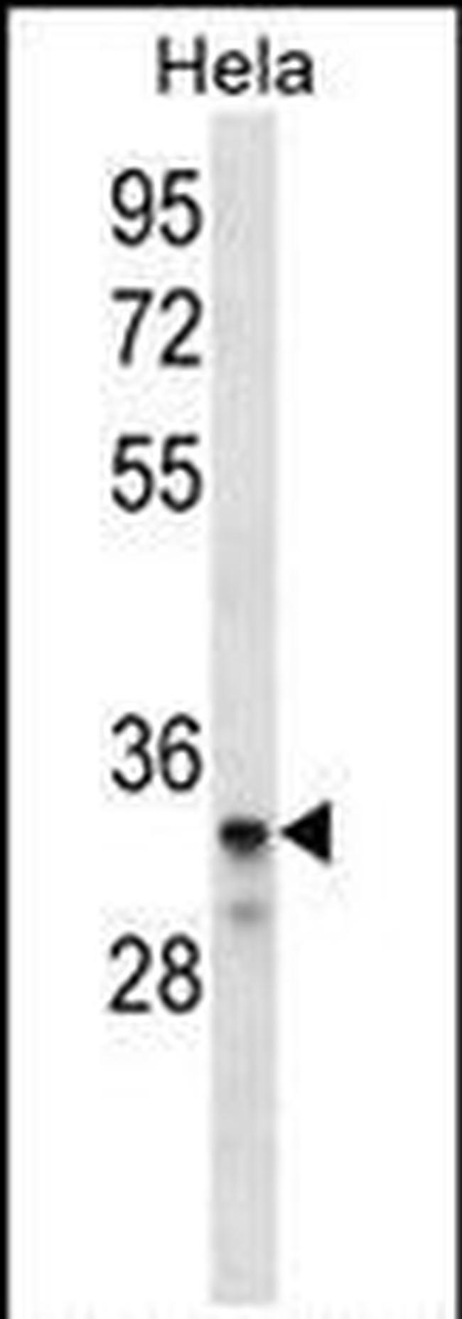 LDLRAD2 Antibody in Western Blot (WB)