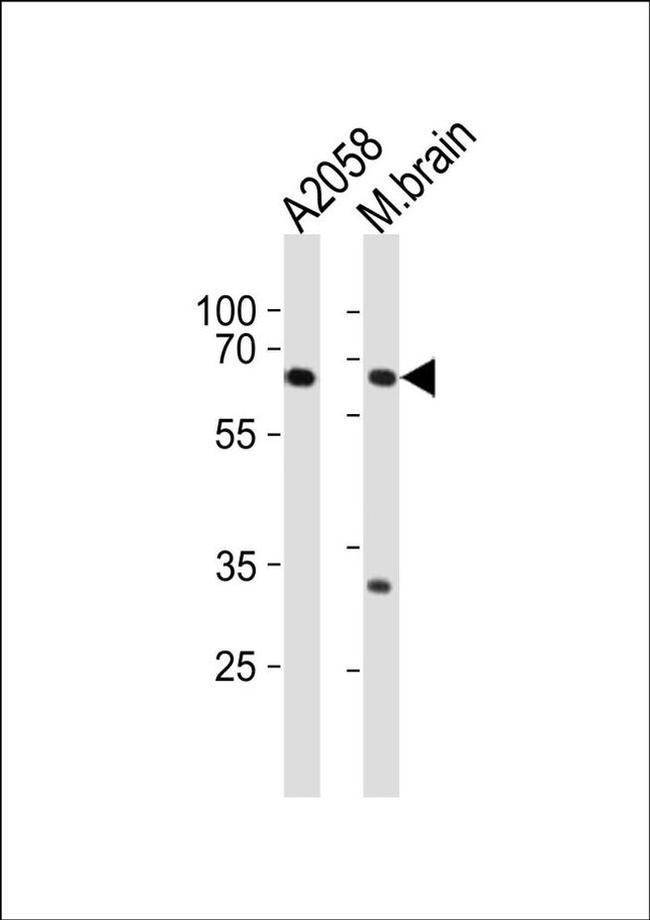 LZTS1 Antibody in Western Blot (WB)