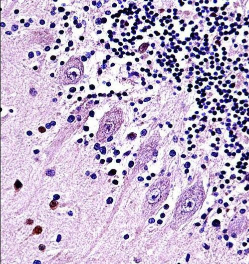 TRPC5 Antibody in Immunohistochemistry (Paraffin) (IHC (P))