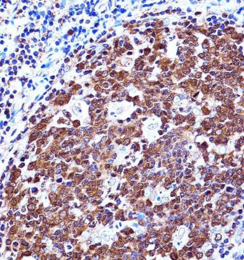 Zap-70 Antibody in Immunohistochemistry (Paraffin) (IHC (P))