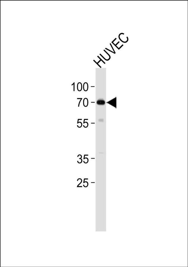 ORC2 Antibody in Western Blot (WB)
