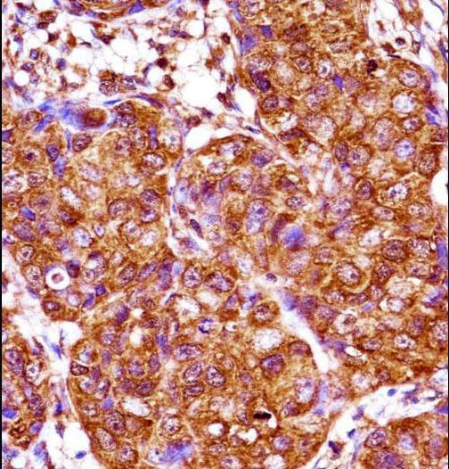 IRX3 Antibody in Immunohistochemistry (Paraffin) (IHC (P))