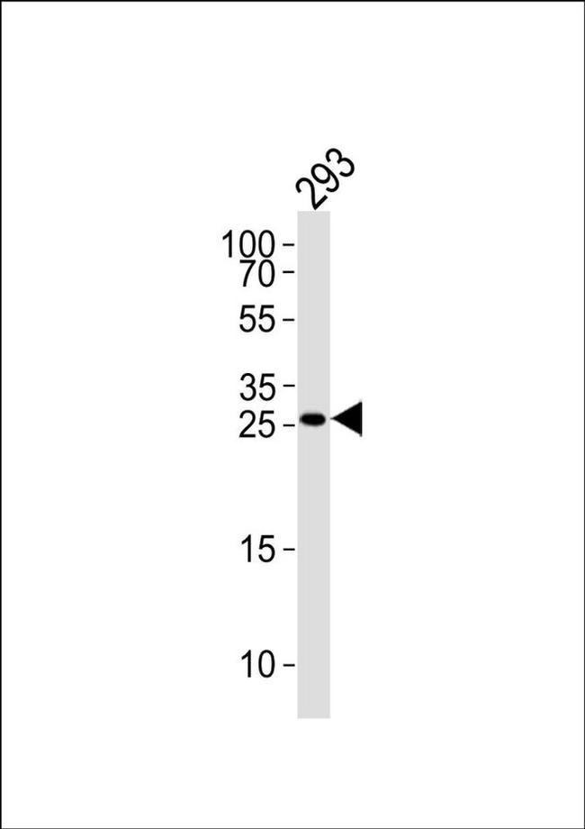 TGIF2 Antibody in Western Blot (WB)
