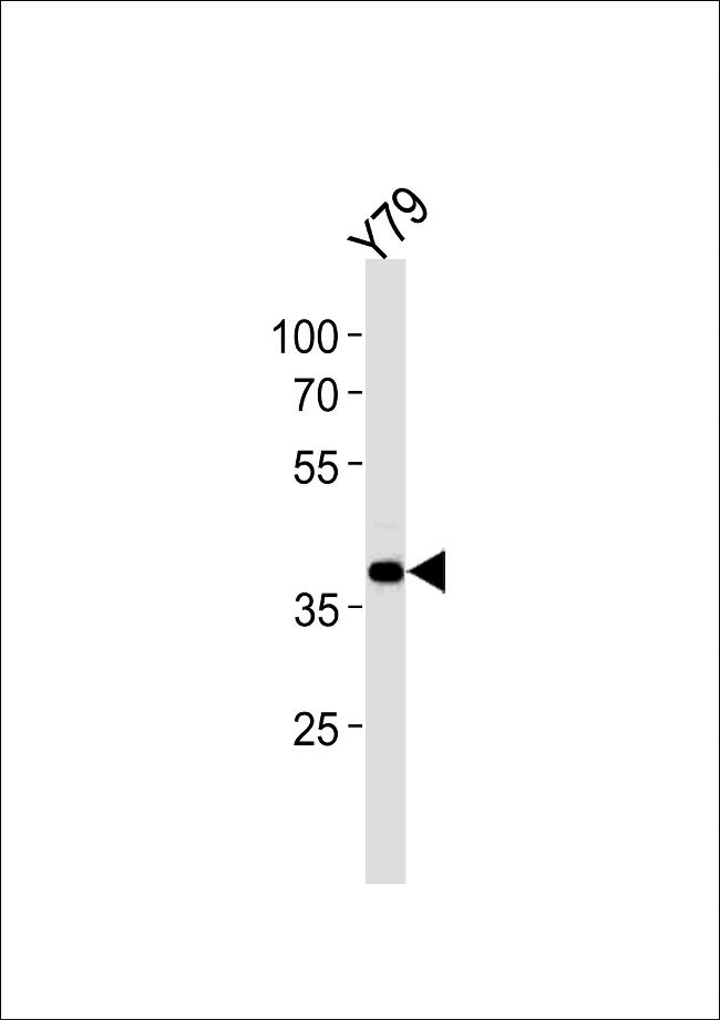 SIX3 Antibody in Western Blot (WB)