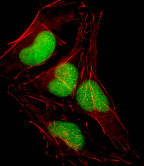 SOX18 Antibody in Immunocytochemistry (ICC/IF)