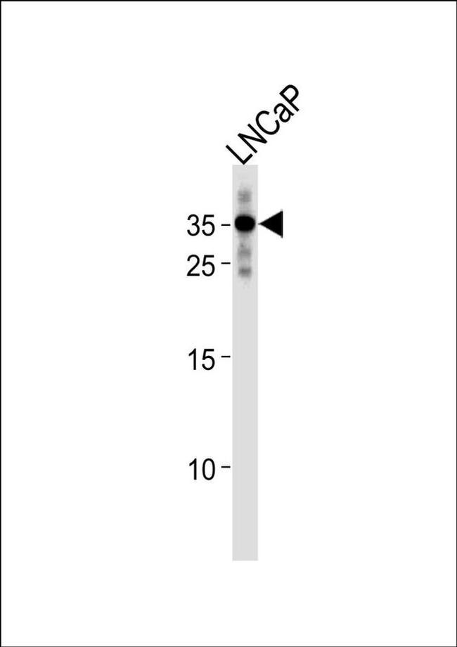 RNF4 Antibody in Western Blot (WB)