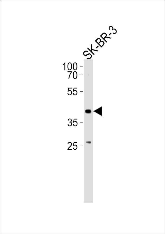 ELK3 Antibody in Western Blot (WB)