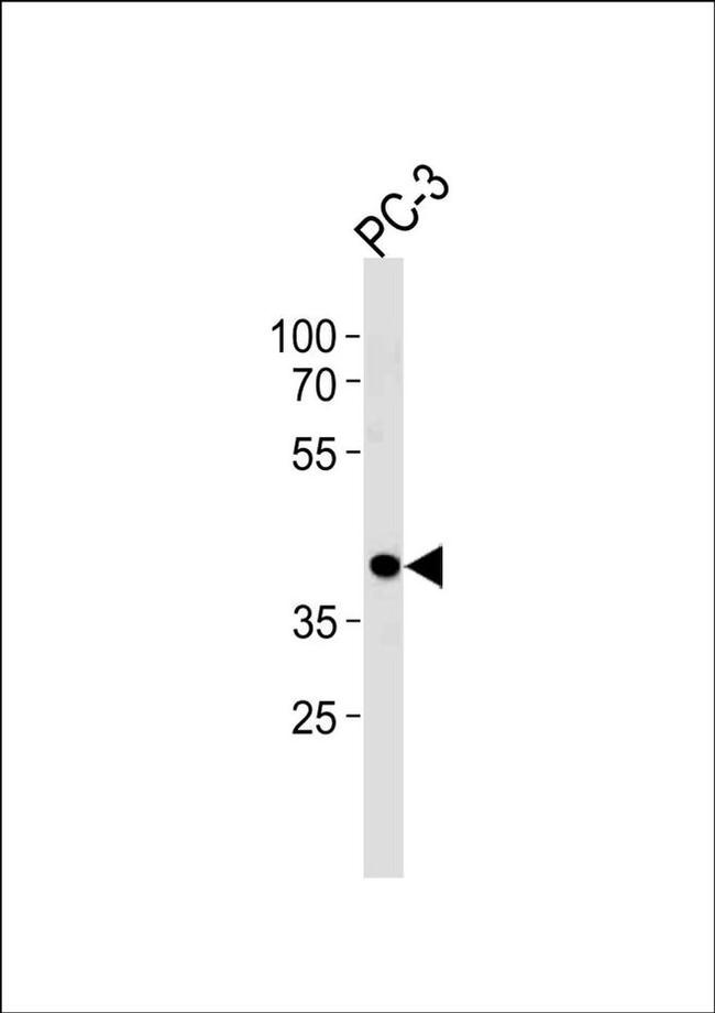 CREB3L4 Antibody in Western Blot (WB)