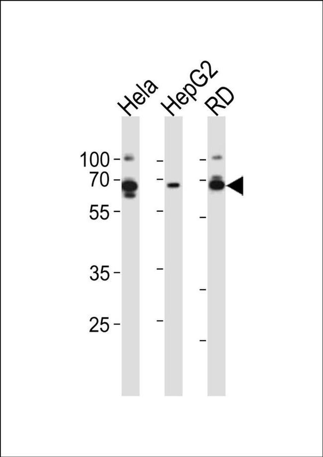 AMPK gamma-3 Antibody in Western Blot (WB)