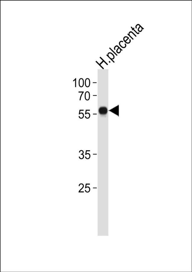 ZNF71 Antibody in Western Blot (WB)