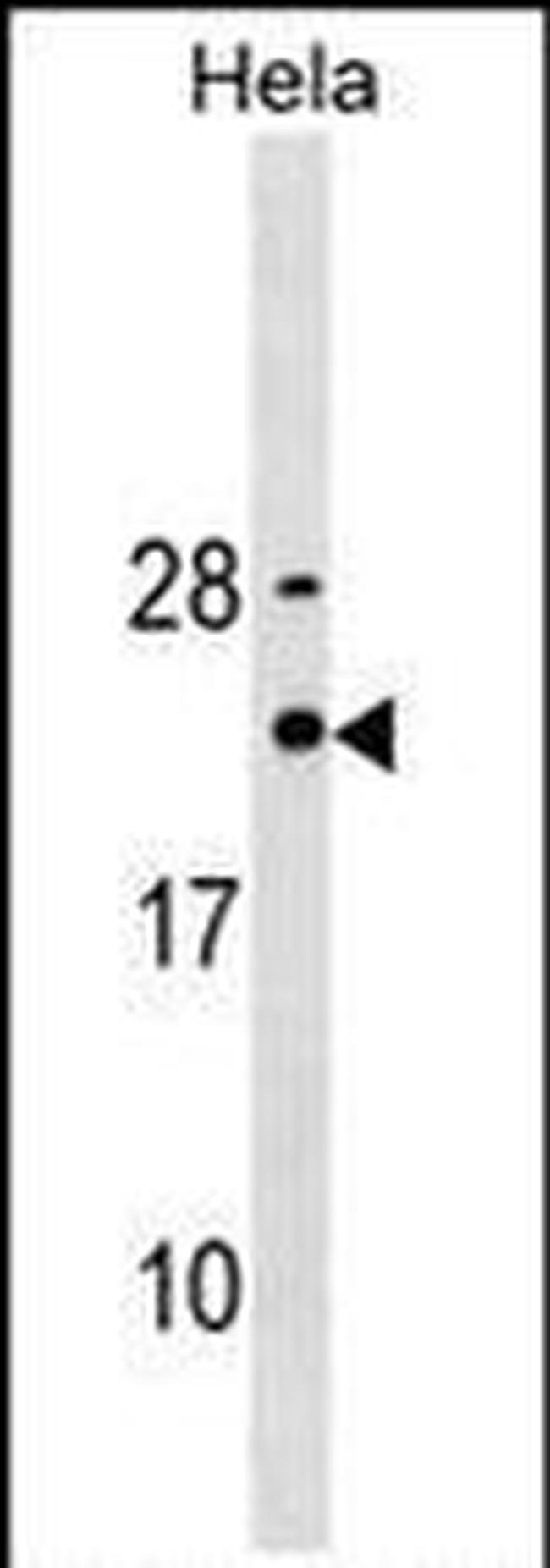 TPT1 Antibody in Western Blot (WB)