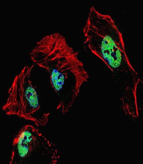 RARB Antibody in Immunocytochemistry (ICC/IF)