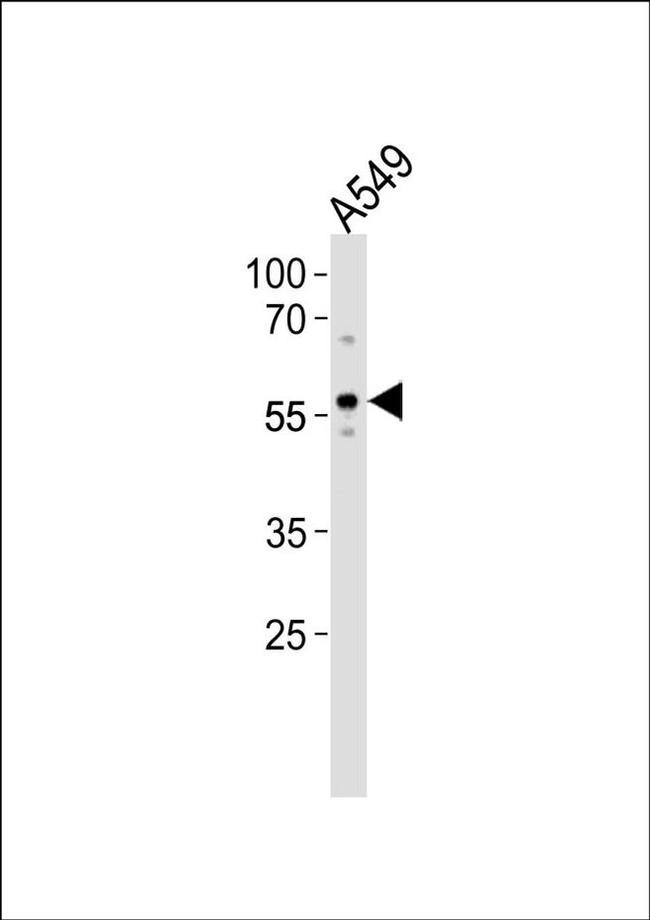 ZKSCAN4 Antibody in Western Blot (WB)
