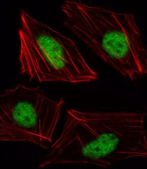 TBX15 Antibody in Immunocytochemistry (ICC/IF)