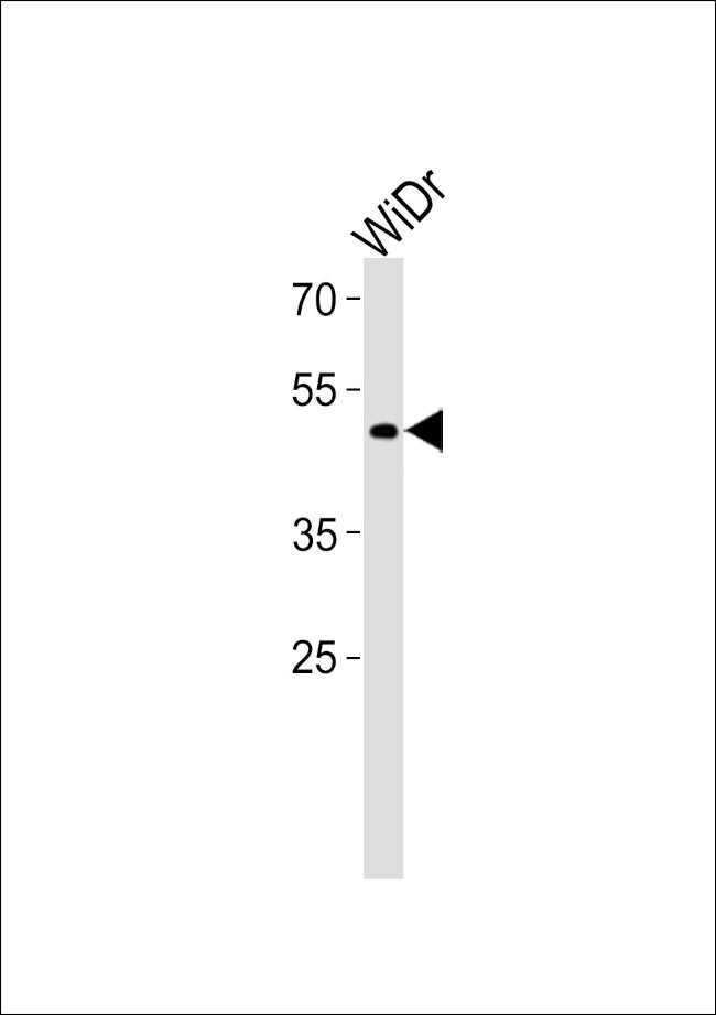 TFDP3 Antibody in Western Blot (WB)