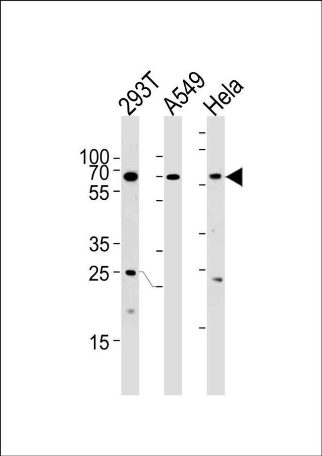 HSF2 Antibody in Western Blot (WB)
