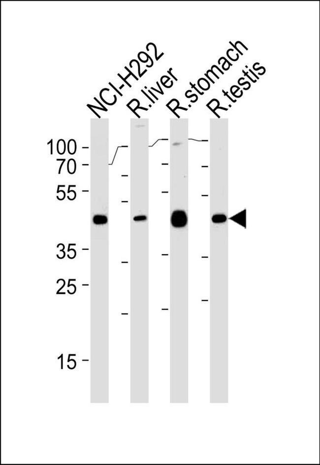 PCGF6 Antibody in Western Blot (WB)
