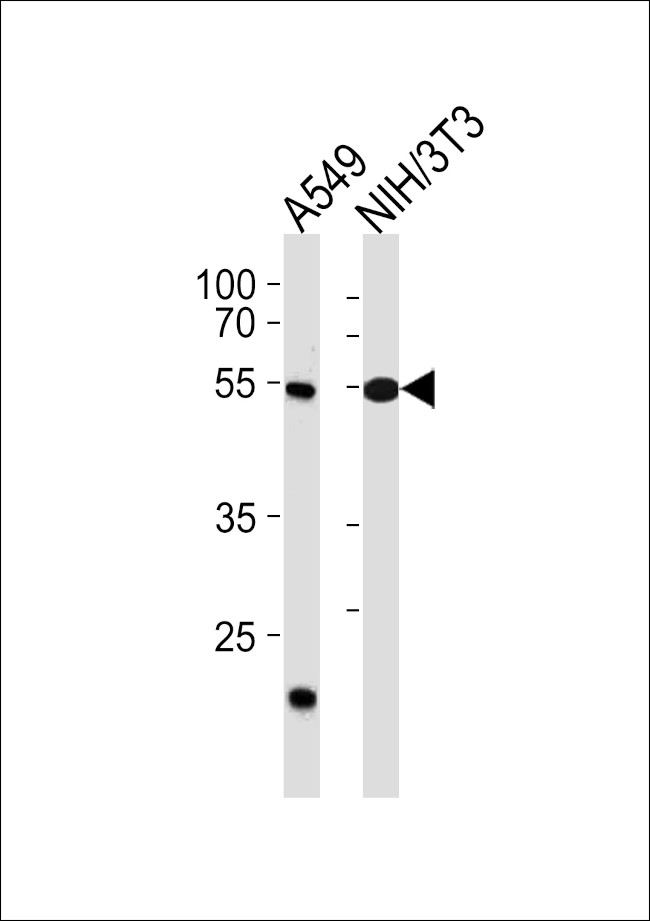 TBX4 Antibody in Western Blot (WB)