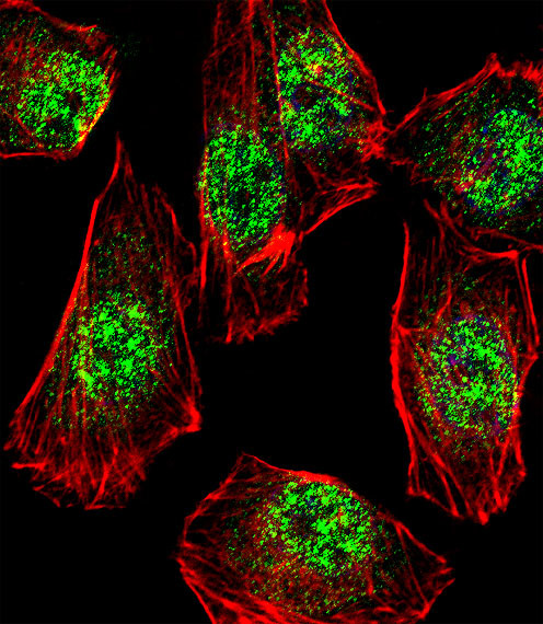 RHOXF2B Antibody in Immunocytochemistry (ICC/IF)