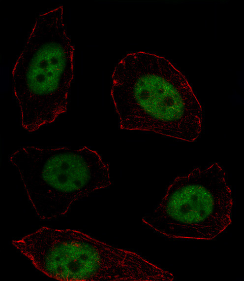 MSX1 Antibody in Immunocytochemistry (ICC/IF)