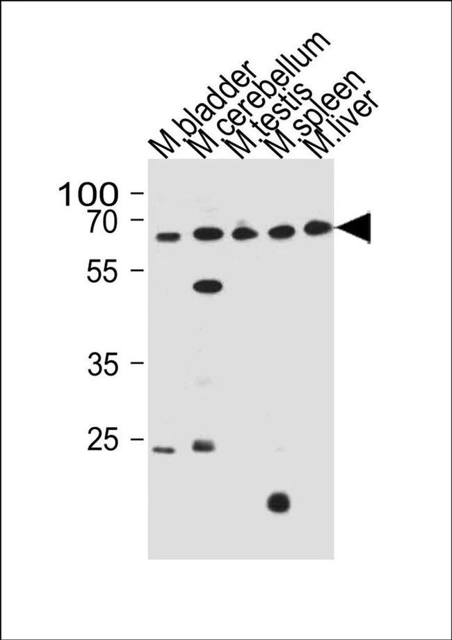 ZNF654 Antibody in Western Blot (WB)