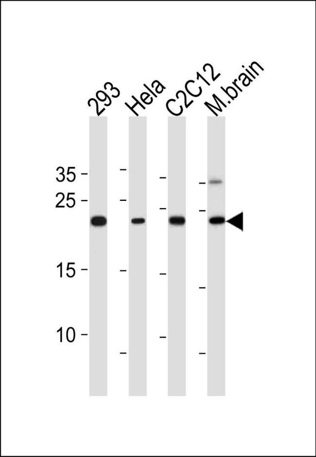 HIP2 Antibody in Western Blot (WB)