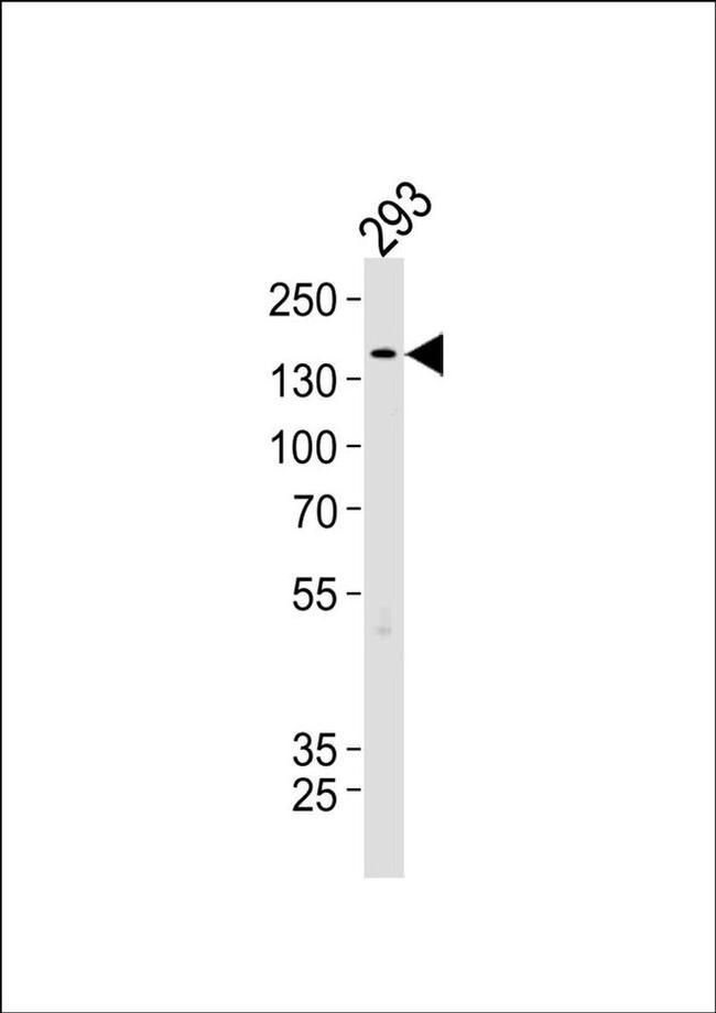 TSC2 Antibody in Western Blot (WB)