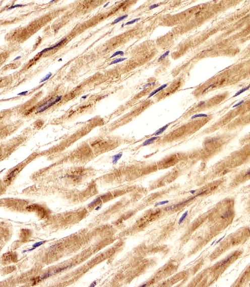 ZNF9 Antibody in Immunohistochemistry (Paraffin) (IHC (P))