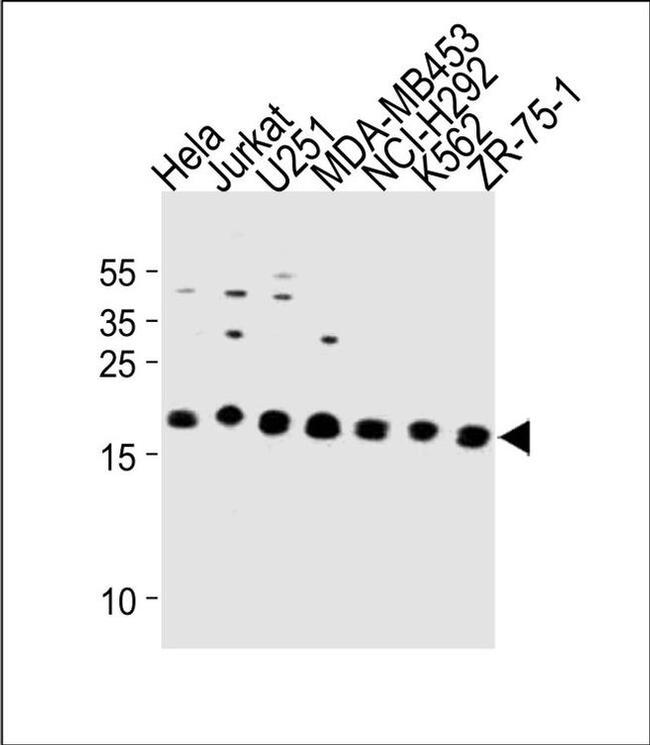 ICT1 Antibody in Western Blot (WB)