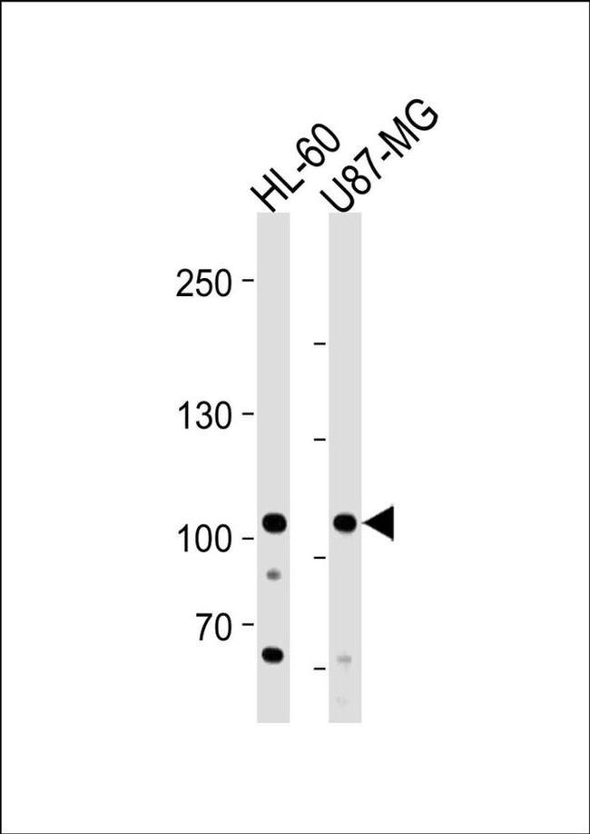 MORC3 Antibody in Western Blot (WB)