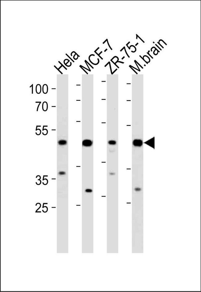 FBXO28 Antibody in Western Blot (WB)