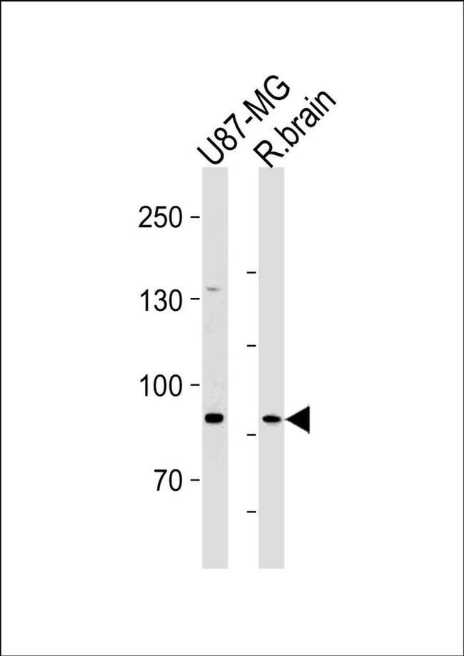 SEMA6B Antibody in Western Blot (WB)