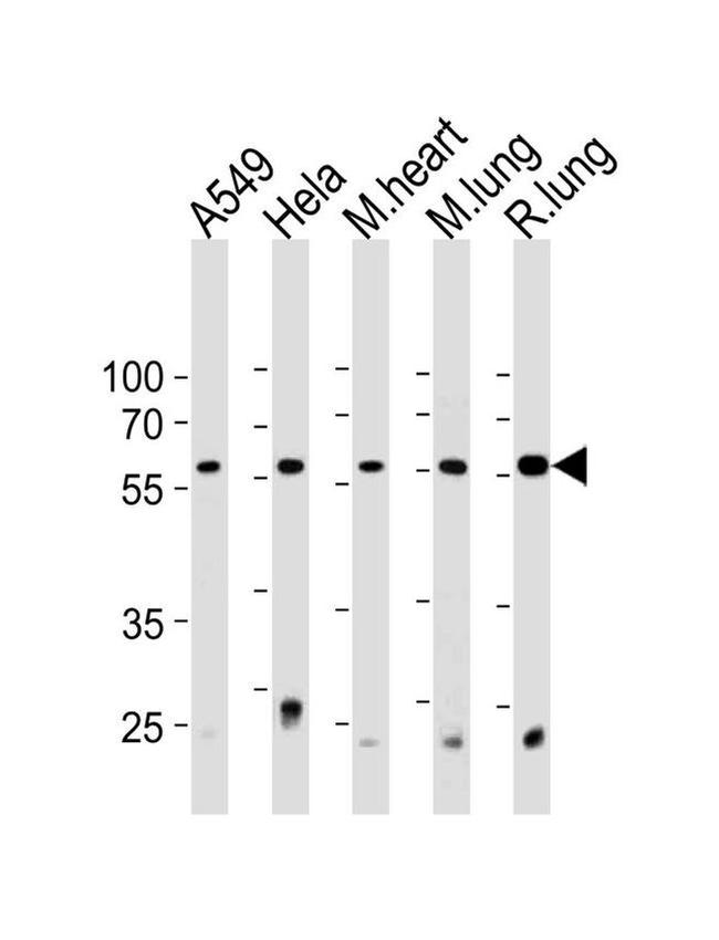 PSMC1 Antibody in Western Blot (WB)