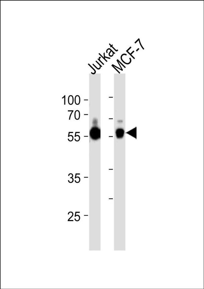 ZNF434 Antibody in Western Blot (WB)