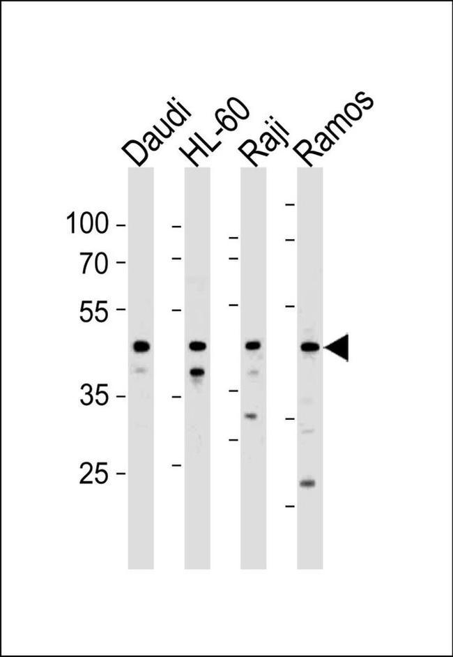 LILRA3 Antibody in Western Blot (WB)