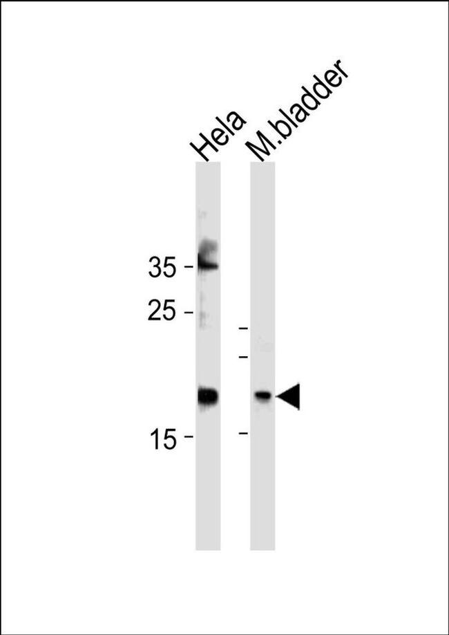 FAM159A Antibody in Western Blot (WB)